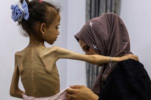 Gaza au &laquo; point de rupture &raquo;, selon une responsable de l'ONU sur place  - Famine G&eacute;nocide &agrave; Gaza Malnutrition ONU PAM Programme alimentaire mondial