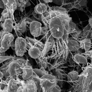 L'humain, ce gros tas de microbes  - ADN Antibiotiques Bact&eacute;ries Biodiversit&eacute; Biologie Champignons G&eacute;n&eacute;tique Hormones Immunit&eacute; Intestin Maladie M&eacute;decine Micro-organisme Microbes Microbiote Microbiote buccal Microbiote intestinal Microbiote pulmonaire Mycobiote Recherche scientifique Sant&eacute; Science Sciences Souris Stress Vid&eacute;o Virus