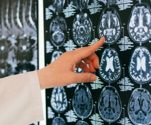Dans le labyrinthe de la douleur, les scientifiques cherchent la sortie  - Addiction Douleur M&eacute;dicaments Neurologie Neurones Neurosciences Nocicepteurs Recherche scientifique Sant&eacute; Science Sciences