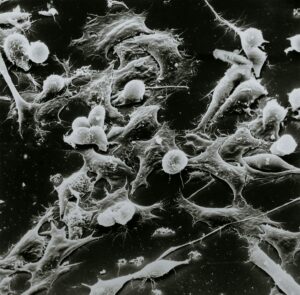 Le "cancer backlash" ou l&rsquo;art de rendre les victimes responsables  - Cancer Cancer backlash CNRS Marc Billaud Pesticides PFAS Pollution Recherche scientifique Sant&eacute; Sant&eacute; publique Science Sciences