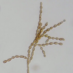 &Agrave; Tchernobyl, un champignon mutant se nourrirait des radiations  - Champignons Cladosporium cladosporioides Radioactivit&eacute; Science Sciences Tchernobyl