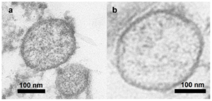 Exosomes : le marketing de l&rsquo;industrie cosm&eacute;tique s&rsquo;emballe, la science avance (lentement)  - Alzheimer Biologie Cancer Exosomes Industrie cosm&eacute;tique M&eacute;decine Recherche scientifique Science Sciences