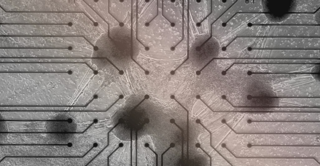 Des neurones humains pour faire tourner des centres de donn&eacute;es  - Cortical Labs Datacenter IA Informatique Intelligence artificielle Neurones Science Sciences