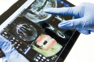 Dans notre bouche, 700 esp&egrave;ces de bact&eacute;ries cohabitent : une d&eacute;couverte change la donne  - Antibiotiques Bact&eacute;ries Dentiste Maladie M&eacute;decine Micro-organisme Microbes Microbiote buccal Recherche scientifique Sant&eacute; Sant&eacute; publique Science Sciences