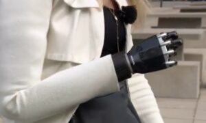La main bionique contr&ocirc;l&eacute;e par la pens&eacute;e change la vie de patients fran&ccedil;ais  - Chirurgie M&eacute;decine Nantes Proth&egrave;ses Sant&eacute; S&eacute;curit&eacute; Sociale T&eacute;moignage Vid&eacute;o
