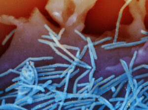 Le rhume devient une piste contre le cancer  - Biologie Cancer D&eacute;couverte scientifique Immunit&eacute; Maladie M&eacute;decine Microbes Poumons Recherche scientifique Rhume Sant&eacute; Sant&eacute; publique Science Sciences Souris Virus